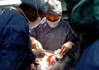 انجام موفقیت آمیز جراحی بازسازی قاعده جمجمه در لامرد